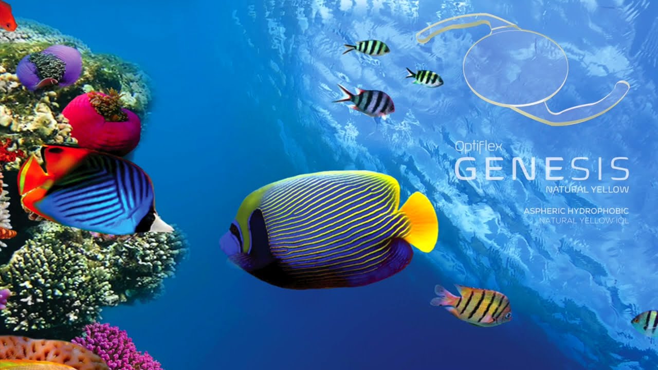 Optiflex GENESIS Loading & Implantation.