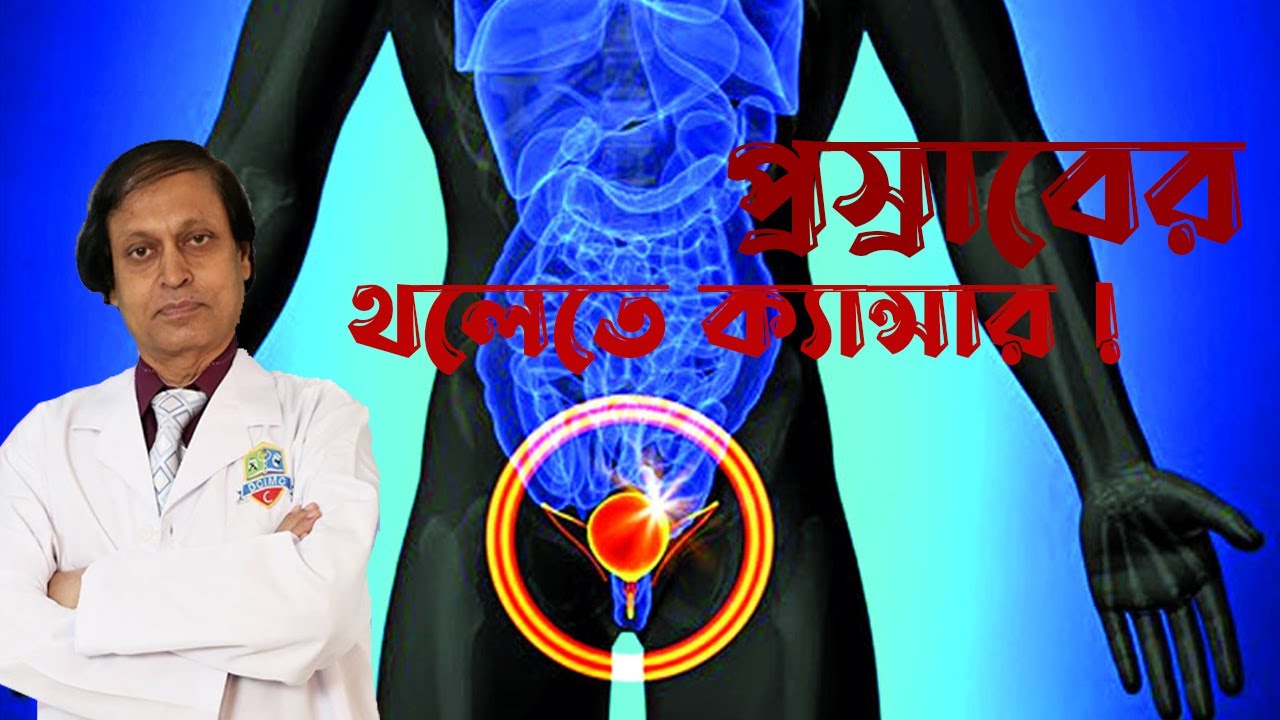 প্রস্রাবের থলিতে ক্যান্সার হলে করনীয়। অধ্যাপক ডাঃ সোহরাব হোসেন সৌরভ। হাসপাতাল