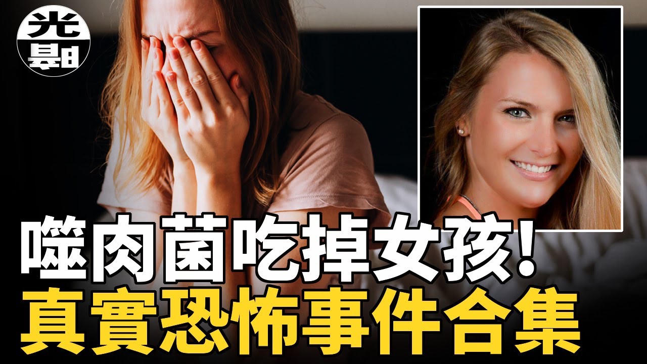 被噬肉菌吃掉四肢！被醫生摘空內臟！？三個真實恐怖事件合集--懸案 刑事 調查 奇聞 檔案 迷案解讀 盡在光暗雜學館