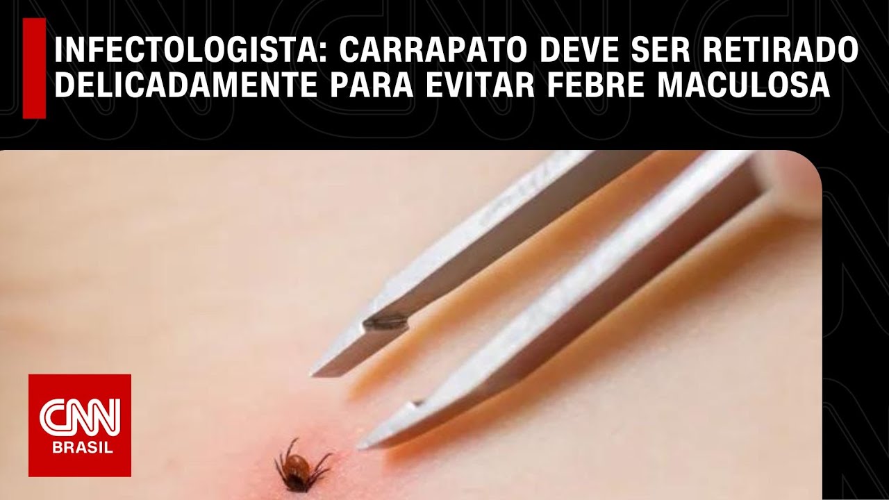 Carrapato deve ser retirado delicadamente para evitar febre maculosa, diz infectologista | LIVE CNN
