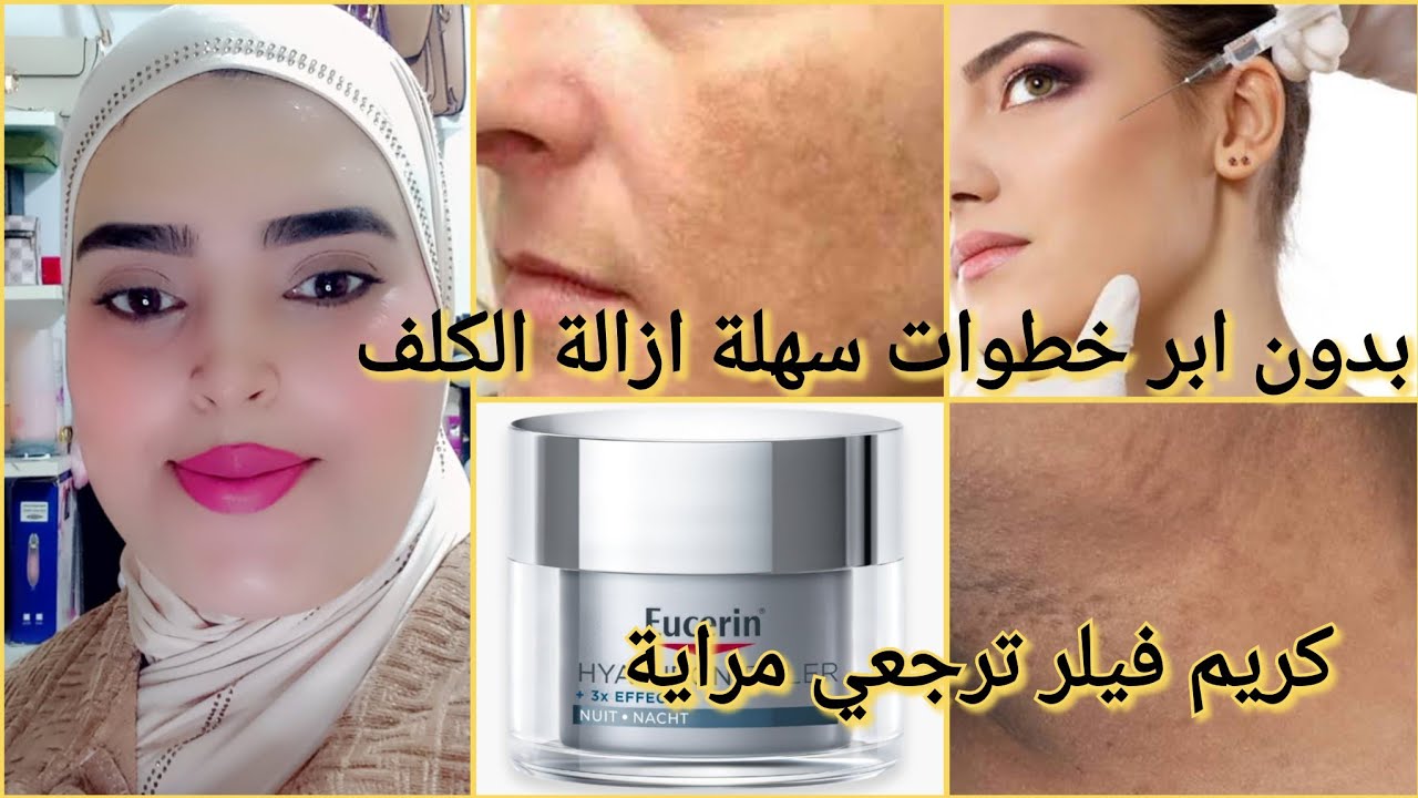 اقوى كريم ضد الكلف 💞سر باش ديرموفال كريم تصفي لك وجهك ومترجعش عليك فيلر بدون جراحة