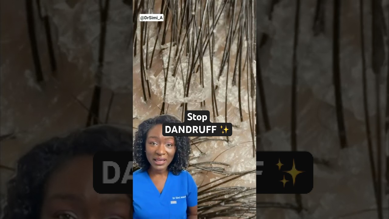 Stop Dandruff + Best Ingredients | Itchy Scalp