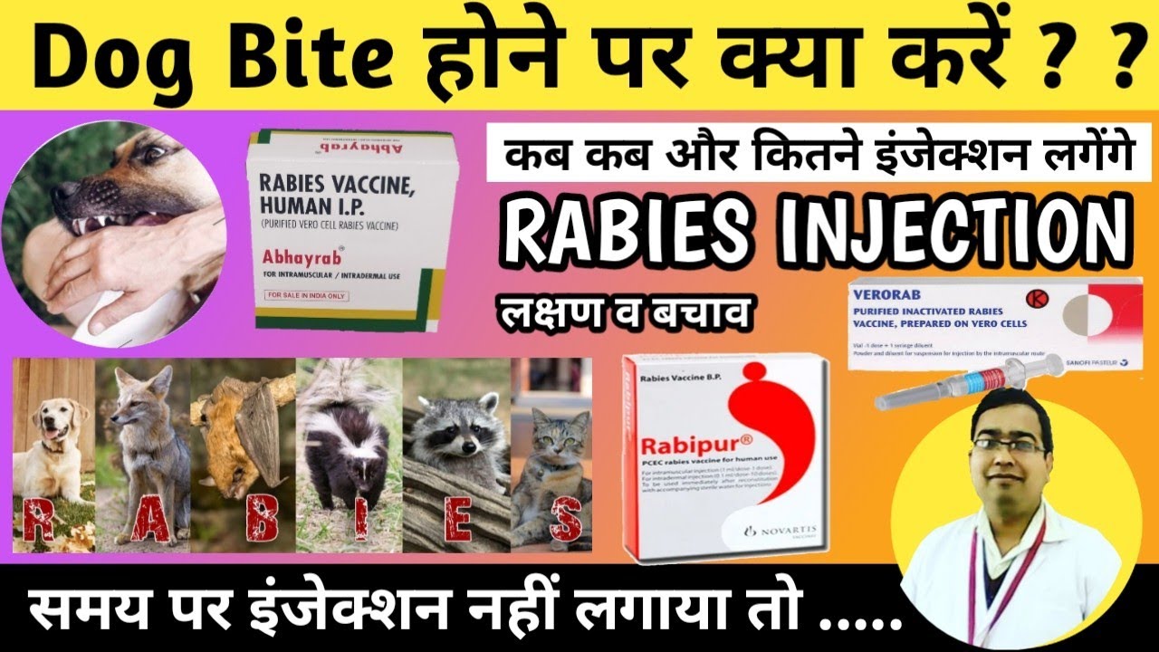 Rabies Vaccine Dose and Schedule | Dog Bite Treatment | Anti Rabies Vaccine | Anti Rabies Injection