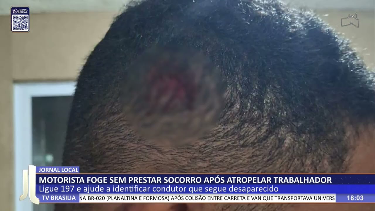 JL -  Motorista foge sem prestar socorro após atropelar trabalhador