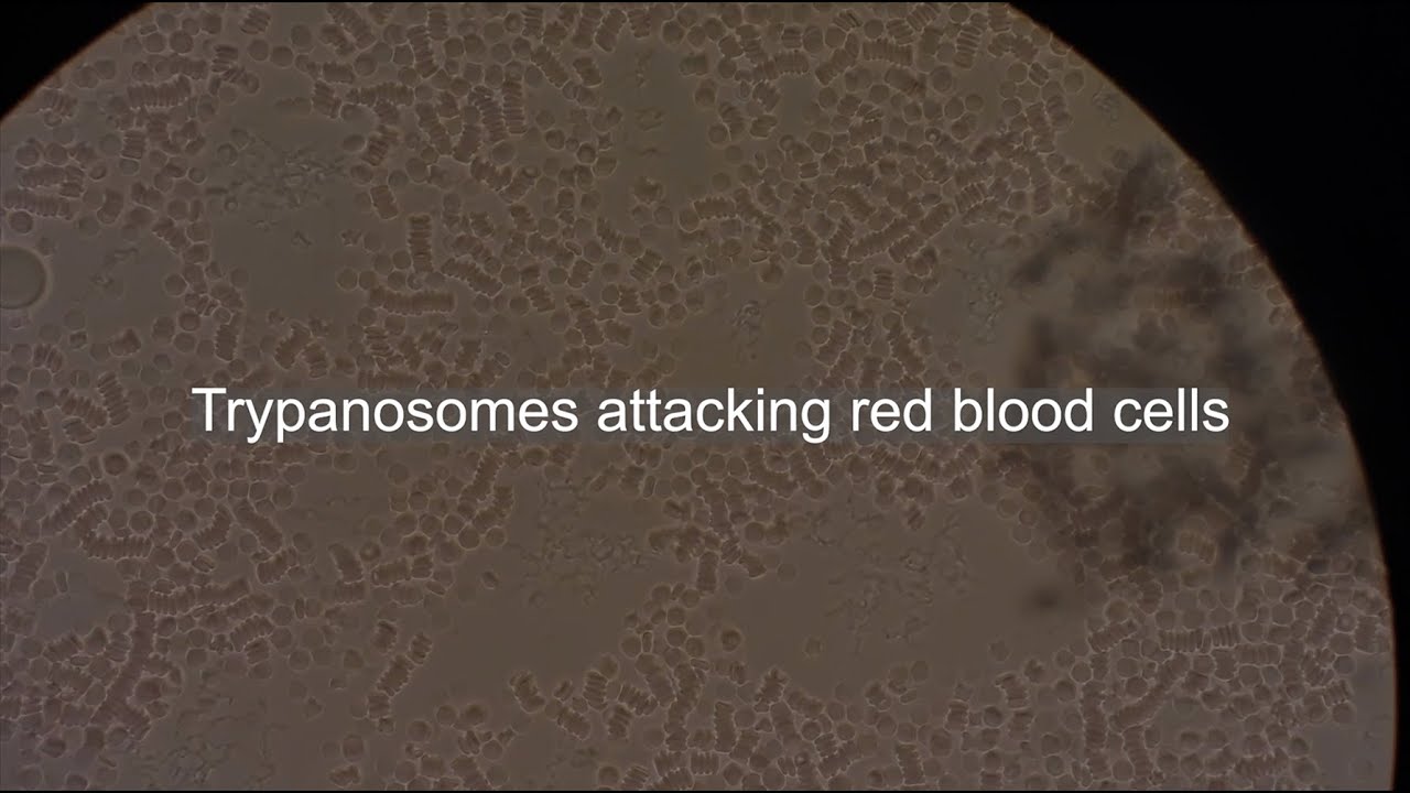 Trypanosomes attacking red blood cells