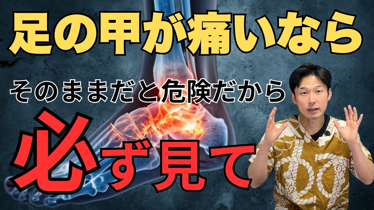 【激痛】足の甲が痛む本当の原因は◯◯でした。湿布を貼る前にこれだけ見て！