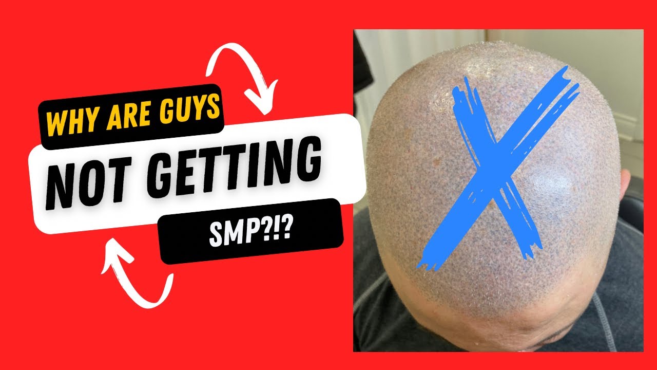 Why Are Guys Not Getting SMP?