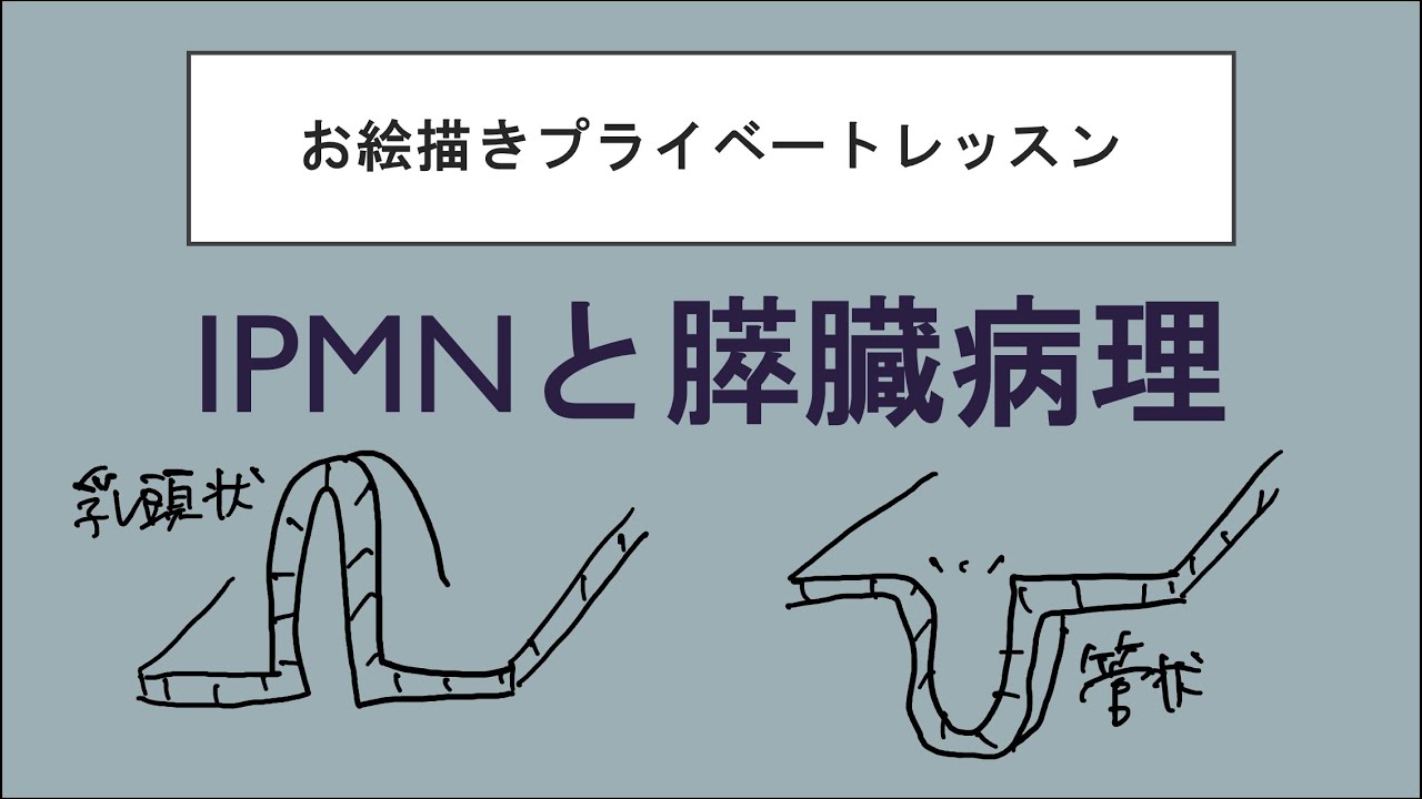 IPMNと膵臓病理　IPMCは上皮内癌って知ってた？