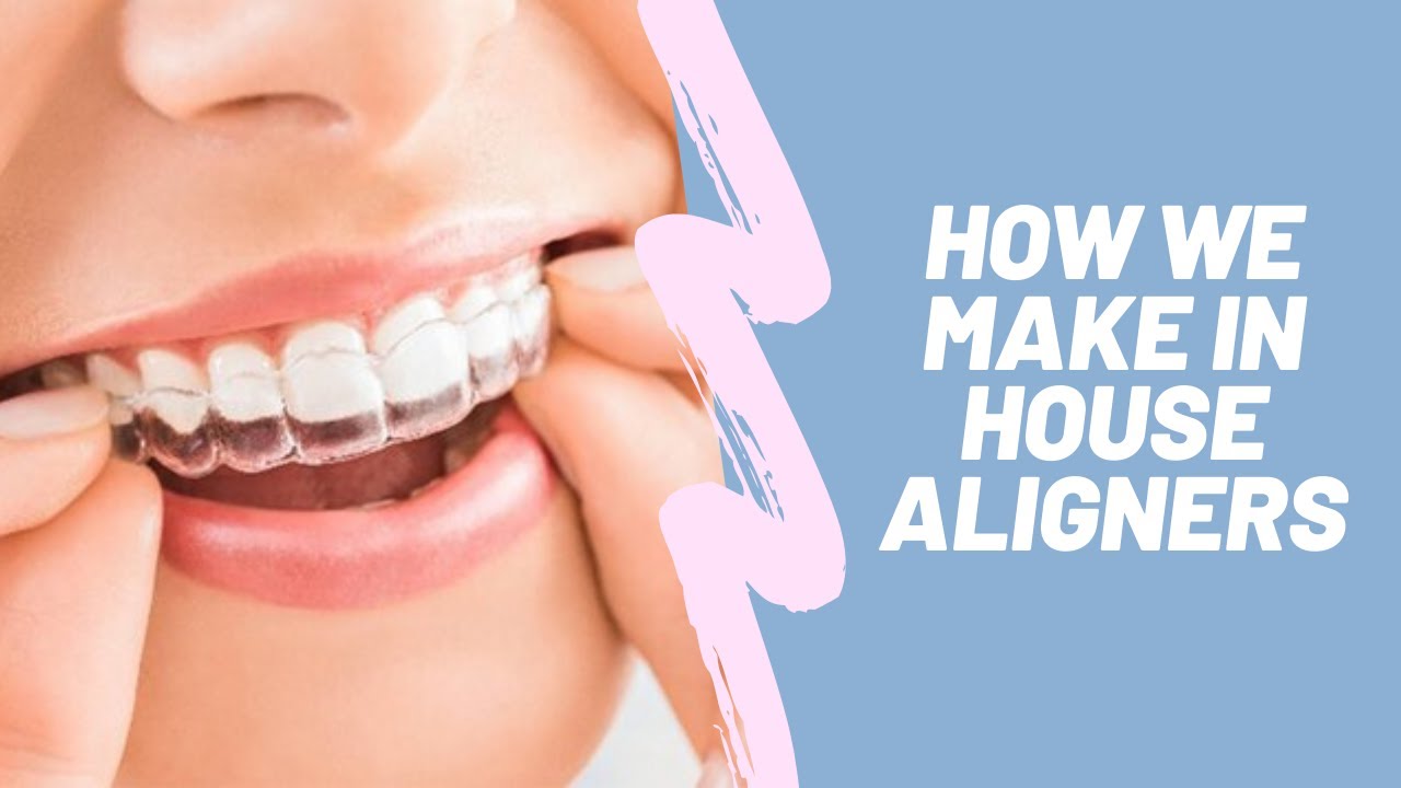 How We Make In-House Aligners Using 3D Printers at The Ranch Orthodontics