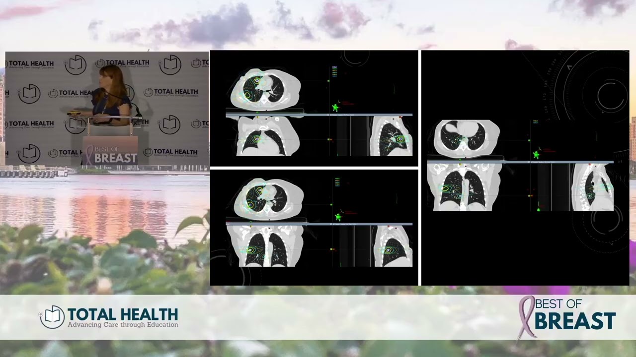 2026 Best of Breast - How Radiation Has Changed in Breast Cancer - Laura Freedman, MD (UofM)