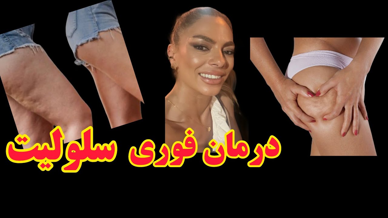 درمان سلولیت (پوست پرتقالی) با روشهای خانگی تضمینی