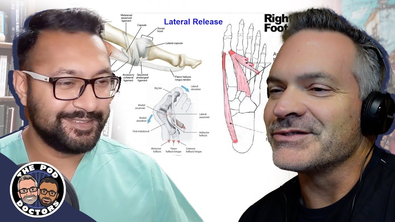 More Than Your Basic Bunion Procedures - The POD Docs