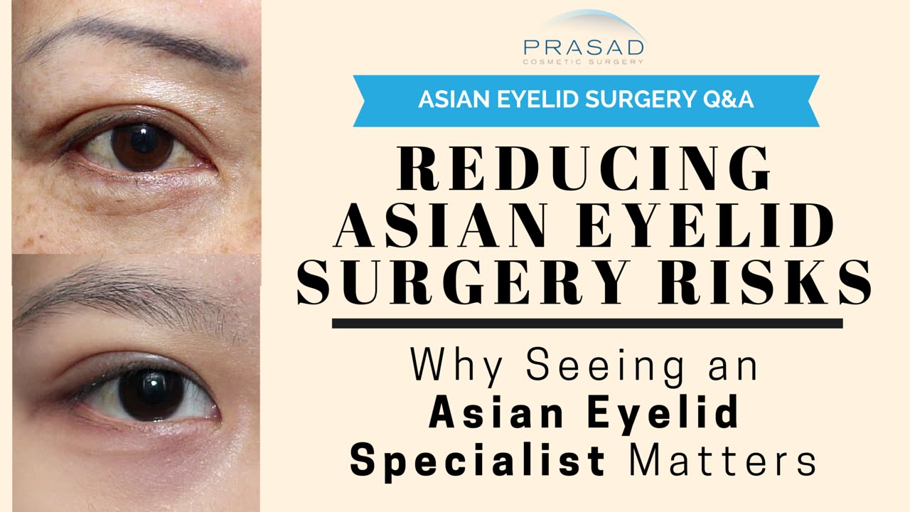 Asian Eyelid Surgery is a Specialty - How to Determine a Specialist to Reduce Surgical Risks