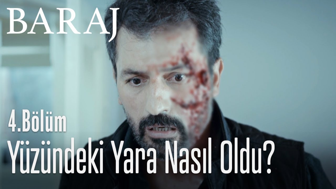 Nazım'ın yüzündeki yara izinin sırrı - Baraj 4. Bölüm