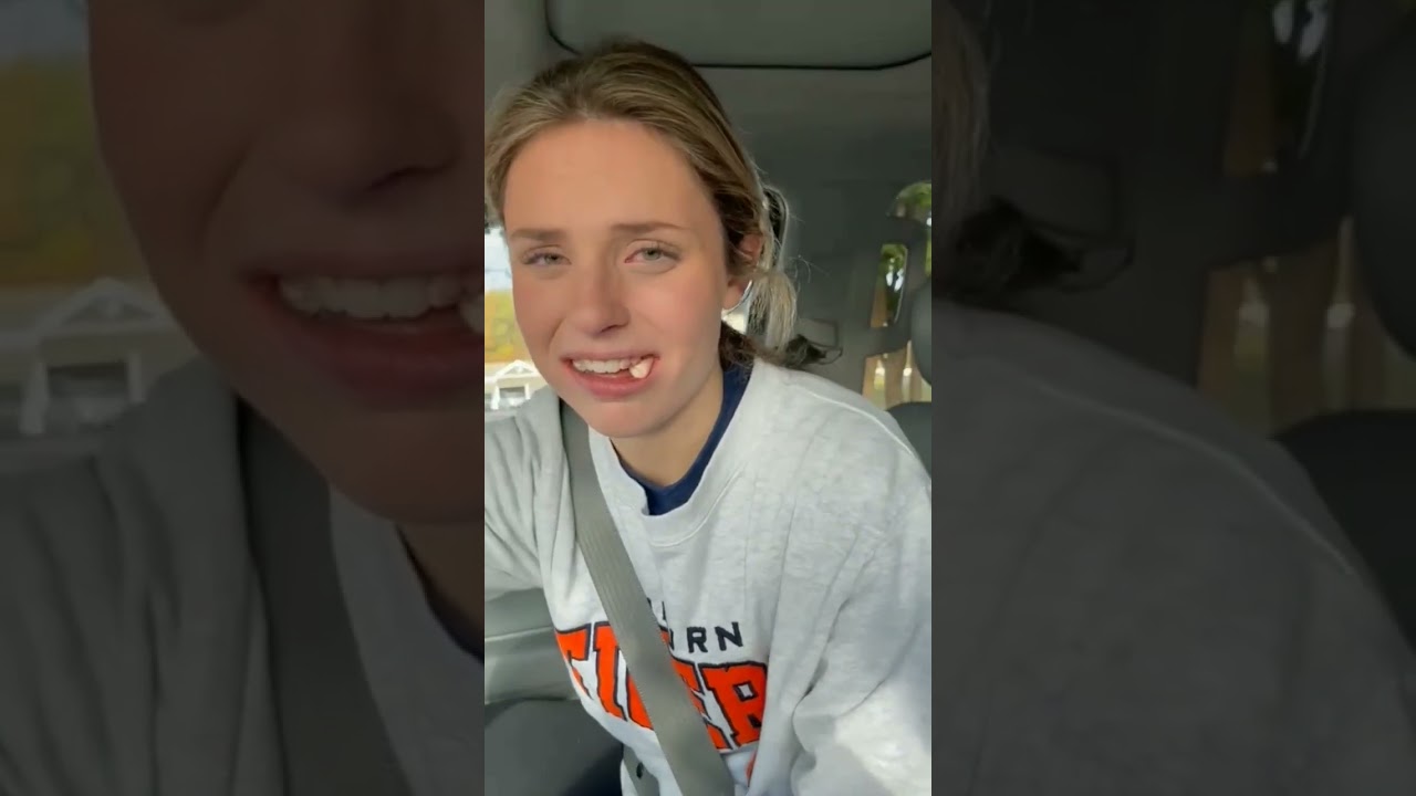 😭    #subscribe      #anesthesia   #wisdomteethremoval #hilarious #funny #relatable via:/Anna clxire