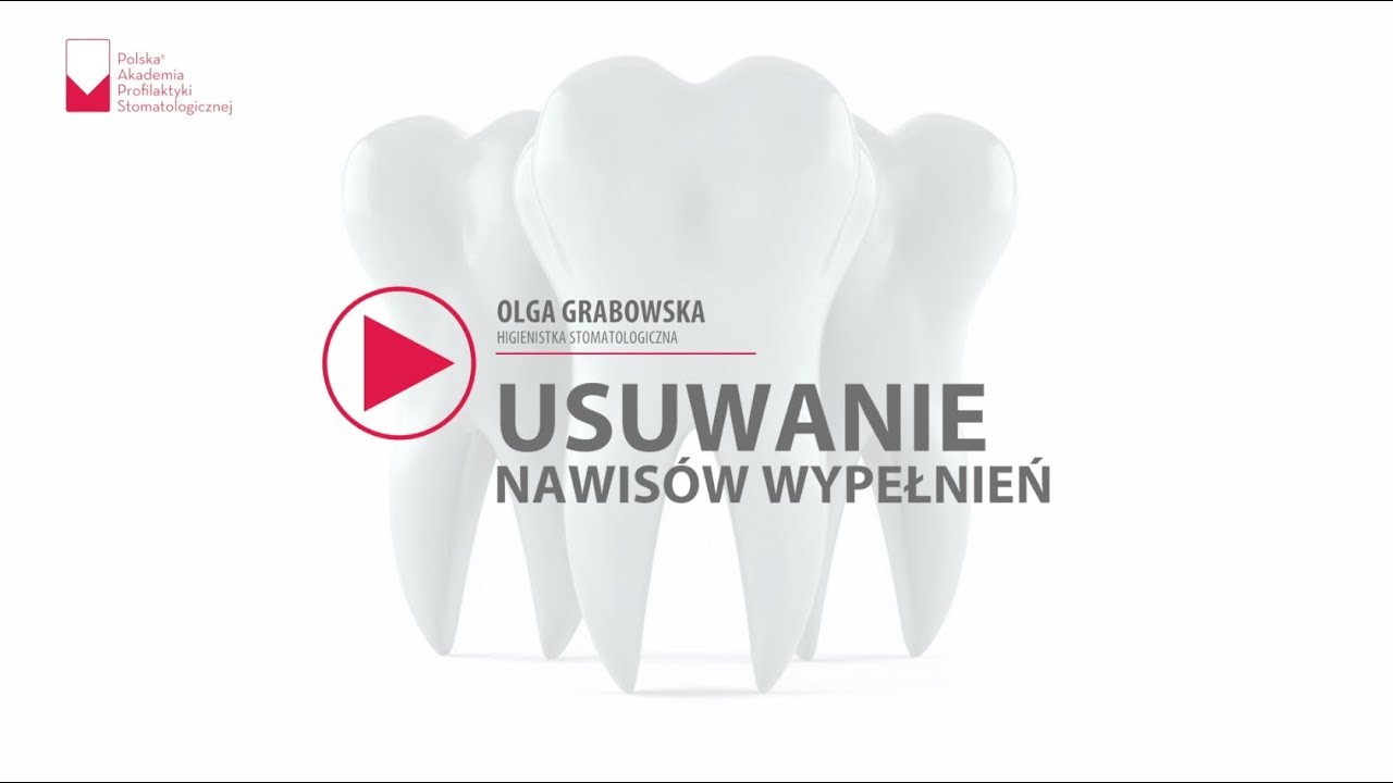 Usuwanie nawisów wypełnień - webinar