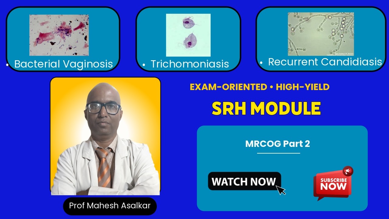 BV, Trichomonas & Recurrent Candidiasis | SRH Module | MRCOG Part 2 SBA & EMQ