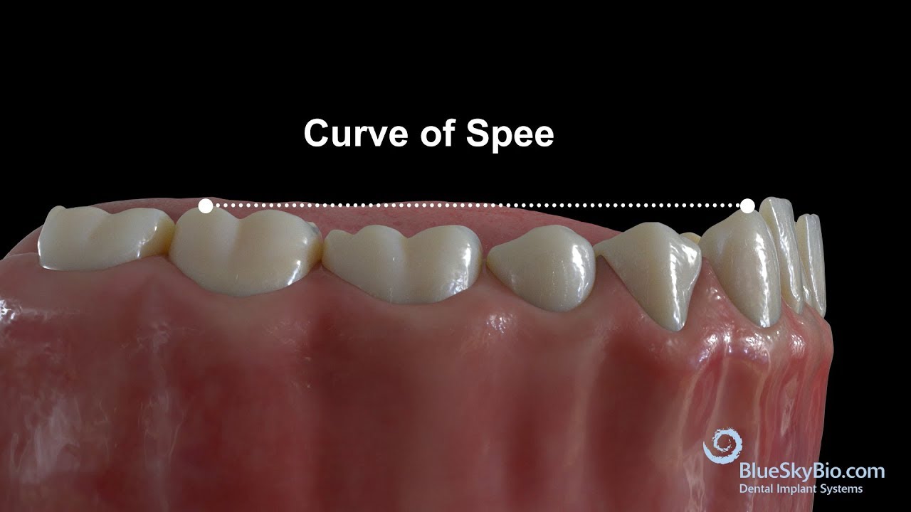 Leveling the Curve of Spee