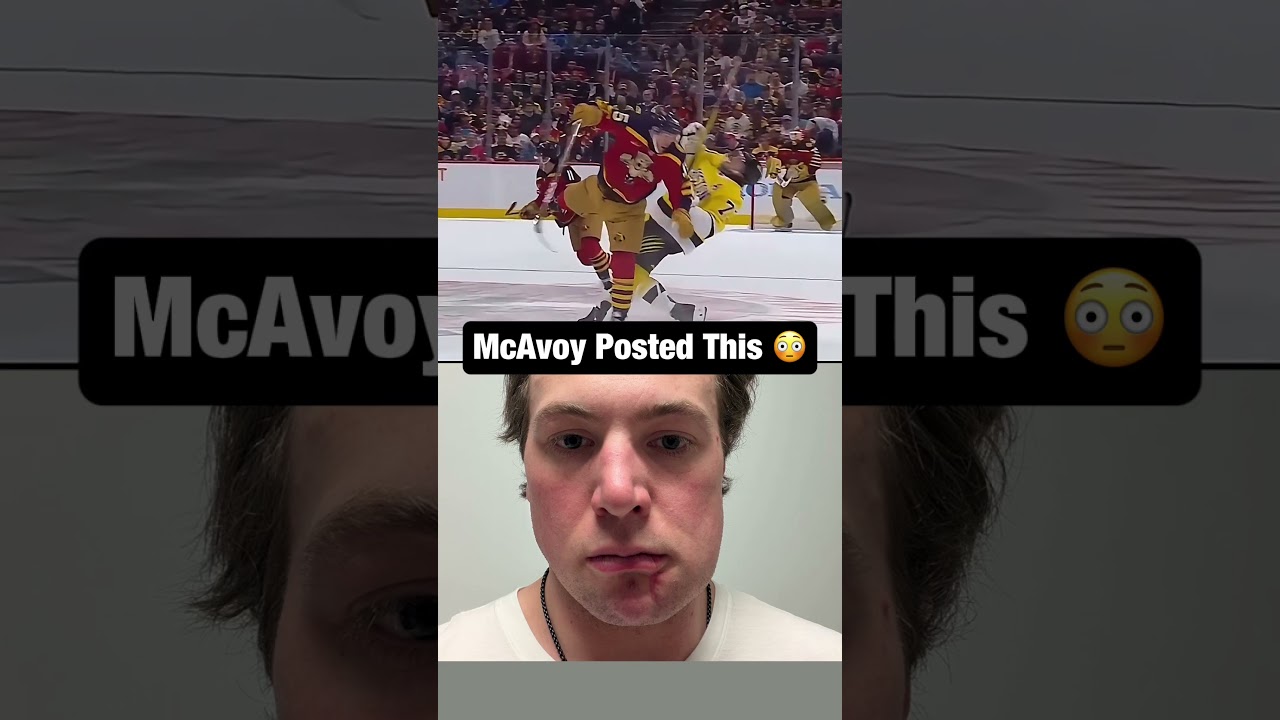 Charlie McAvoy proves his injury 😳🤕 #hockey #nhl
