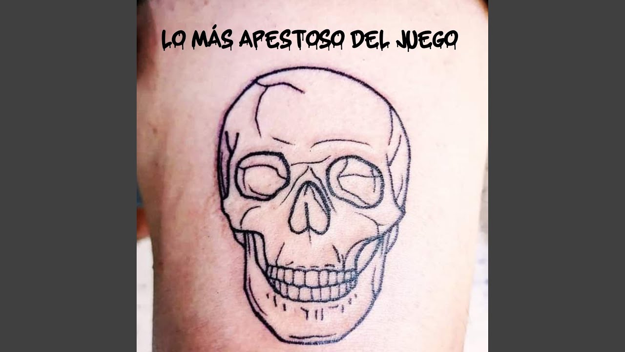 Lo Más Apestoso del Juego