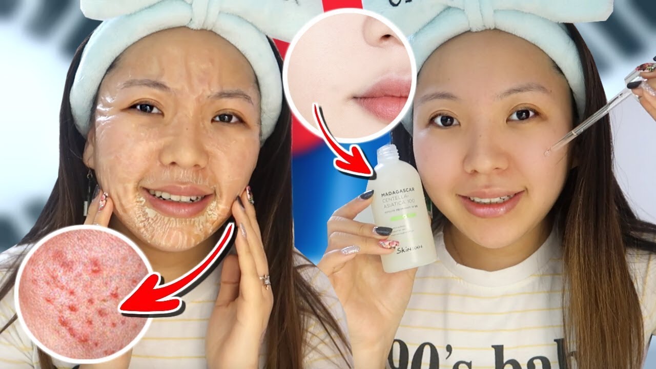 Секрет Кореянок! Зомби-МАСКА! Простой Уход За ПРОБЛЕМНОЙ КОЖЕЙ! Skin1004|NikyMacAleen