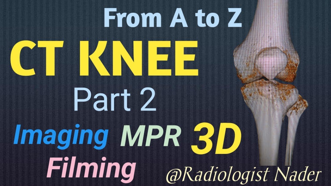 مقطعية علي مفصل الركبة.الجزء الثاني.صور ثلاثية الابعاد CT Knee joint.Part 2.3D.Filming