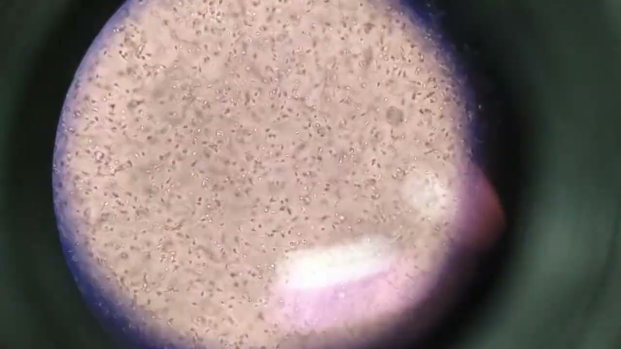 No clumping are present under microscopic alide Semen Analysis