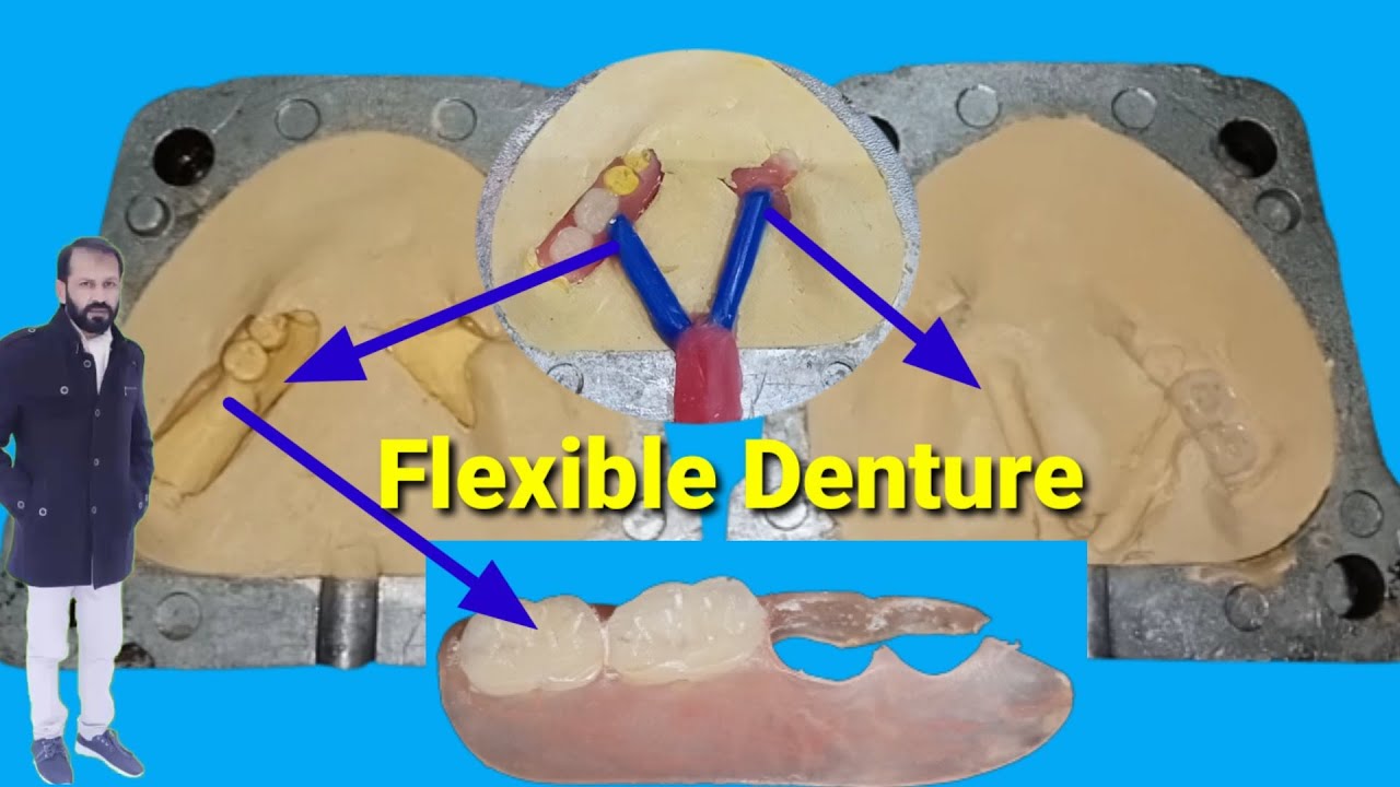 Procedure of Flexible Denture || How to Make Flexible Denture|| Flexible Denture by Haider.....
