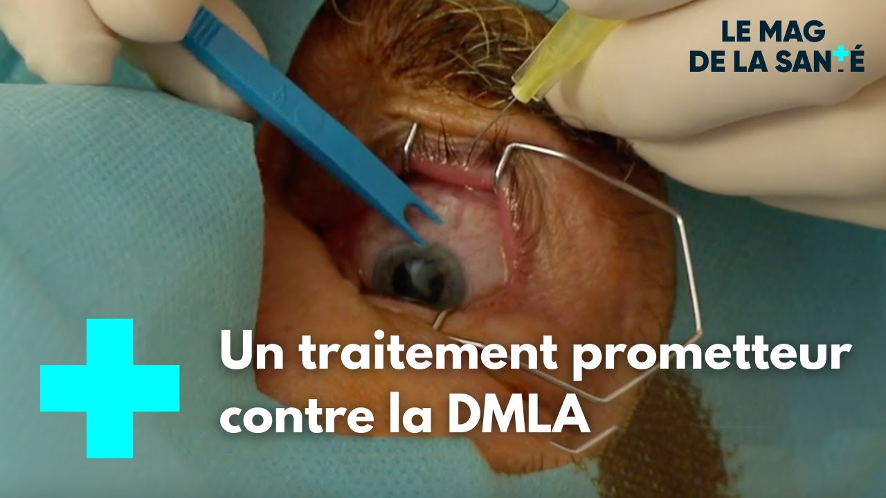 Maladies de la macula : un traitement innovant - Le Magazine de la Sant&eacute;