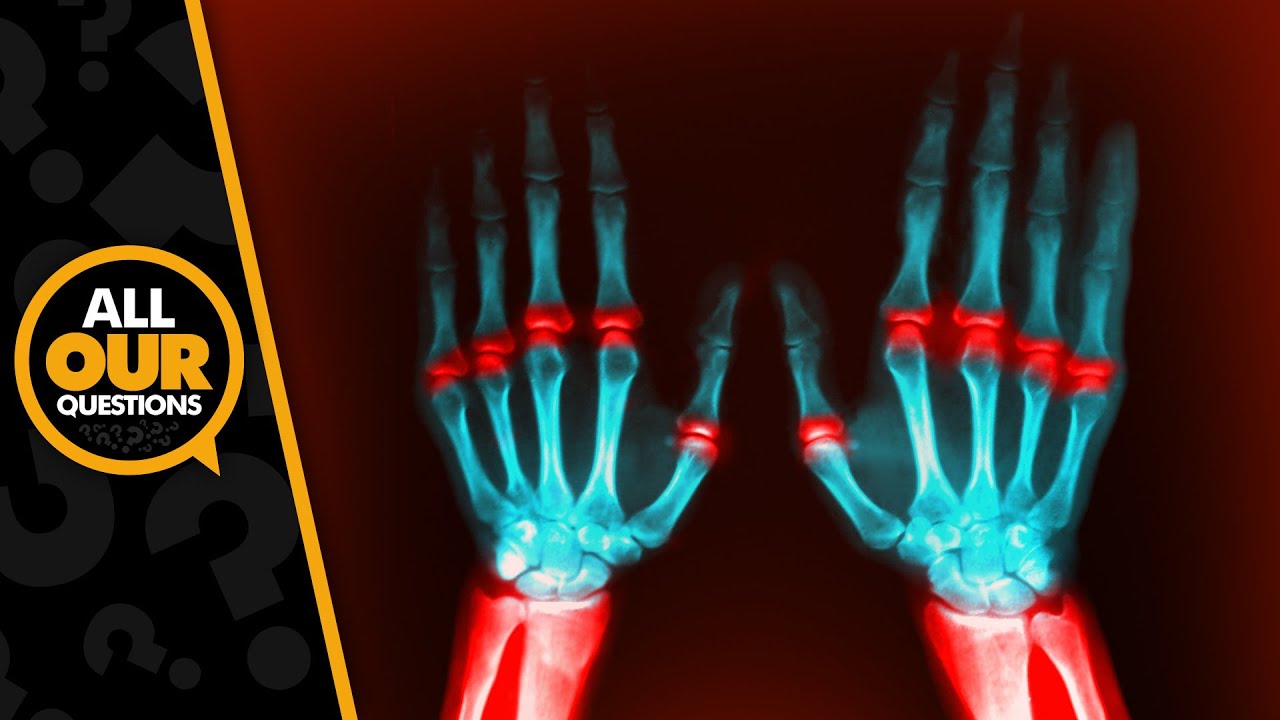 What Happens When We Crack Our Knuckles?