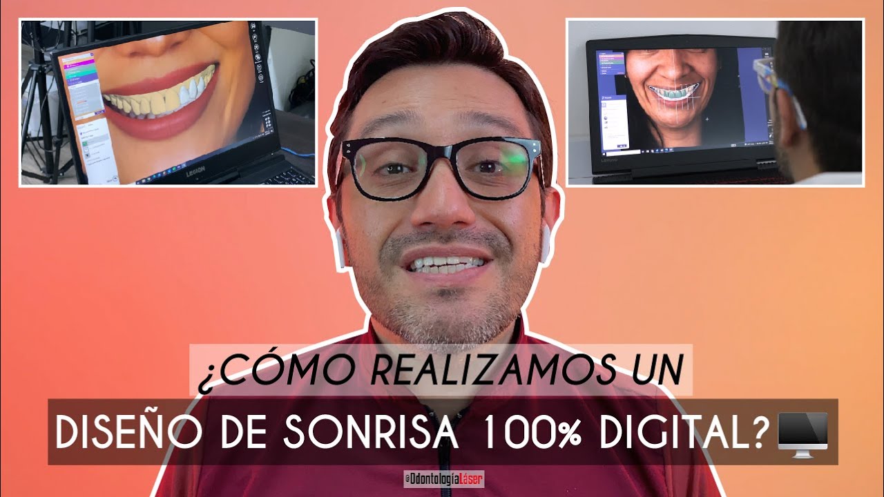 Diseño de Sonrisa Digital ¿Cómo se realiza? 🦷 ¿Qué ventajas tiene? 😎- Odontología Láser