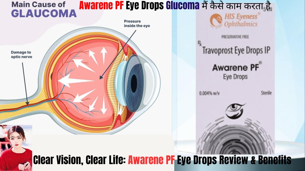 STOP Wasting Money on Ineffective Eye Drops Try AWARENE-PF Instead!