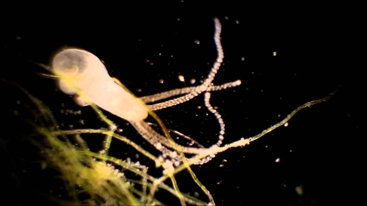 Microscopic Pond Life in a Dark Field Microscope