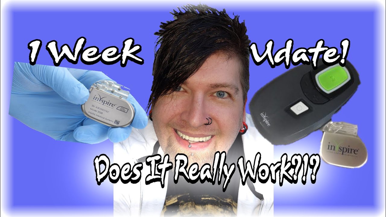 Inspire sleep apnea ( Does It Really Work? )