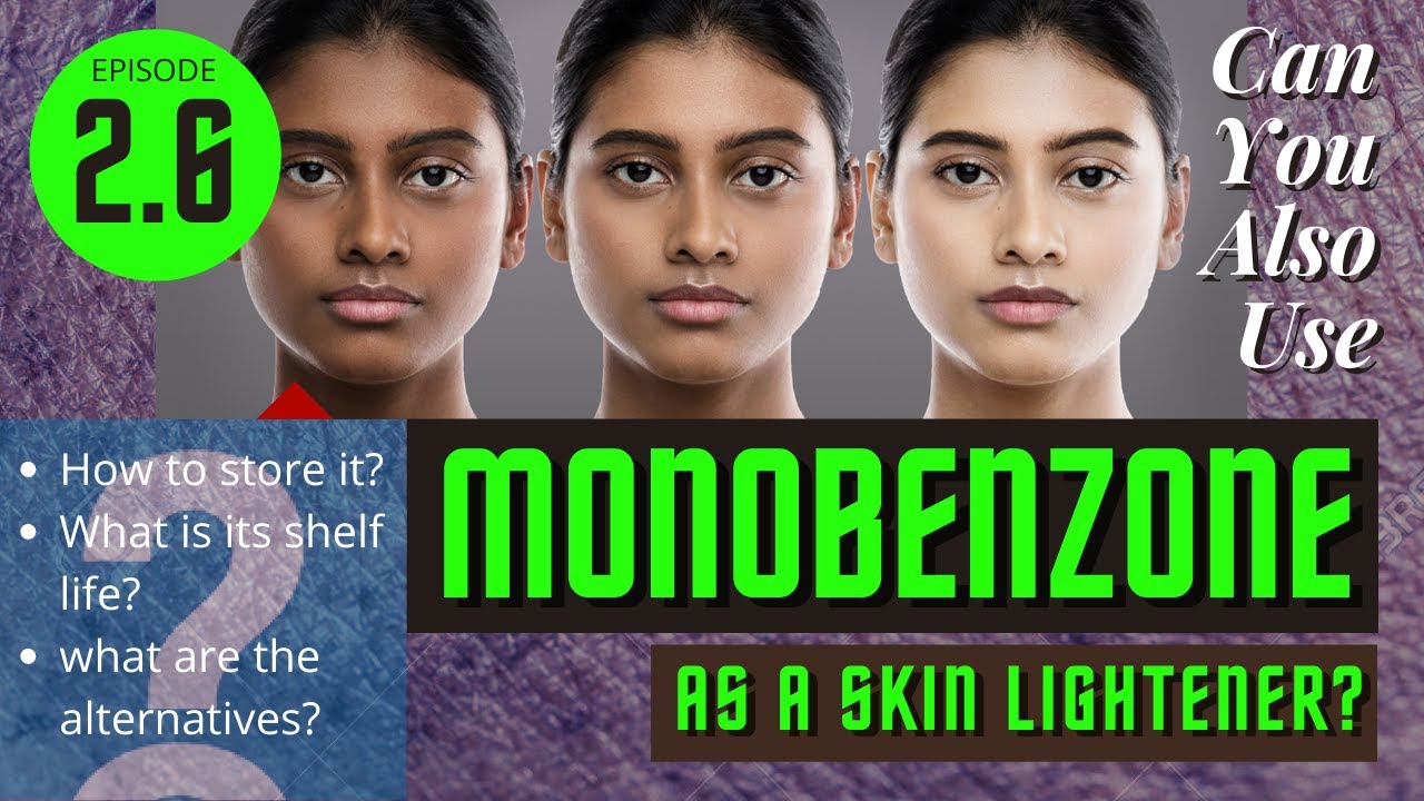 Ep 2.6- Can you use Monobenzone as a skin lightener?