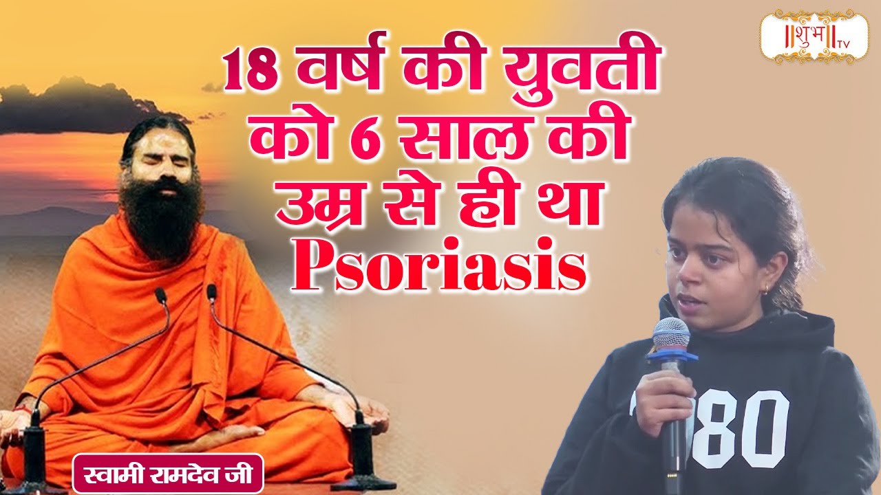 18 वर्ष की युवती को 6 साल की उम्र से ही था Psoriasis  Swami Ramdev Ji | Shubh TV