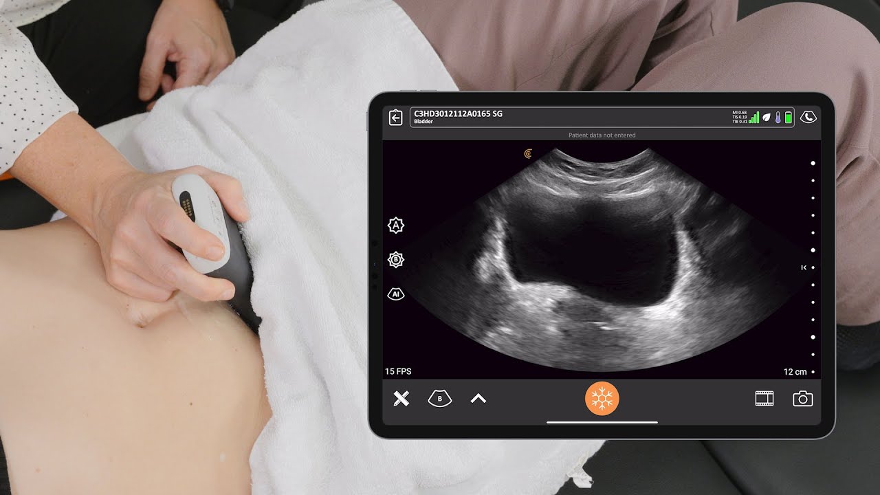 Transabdominal Pelvic Floor Assessment with Ultrasound