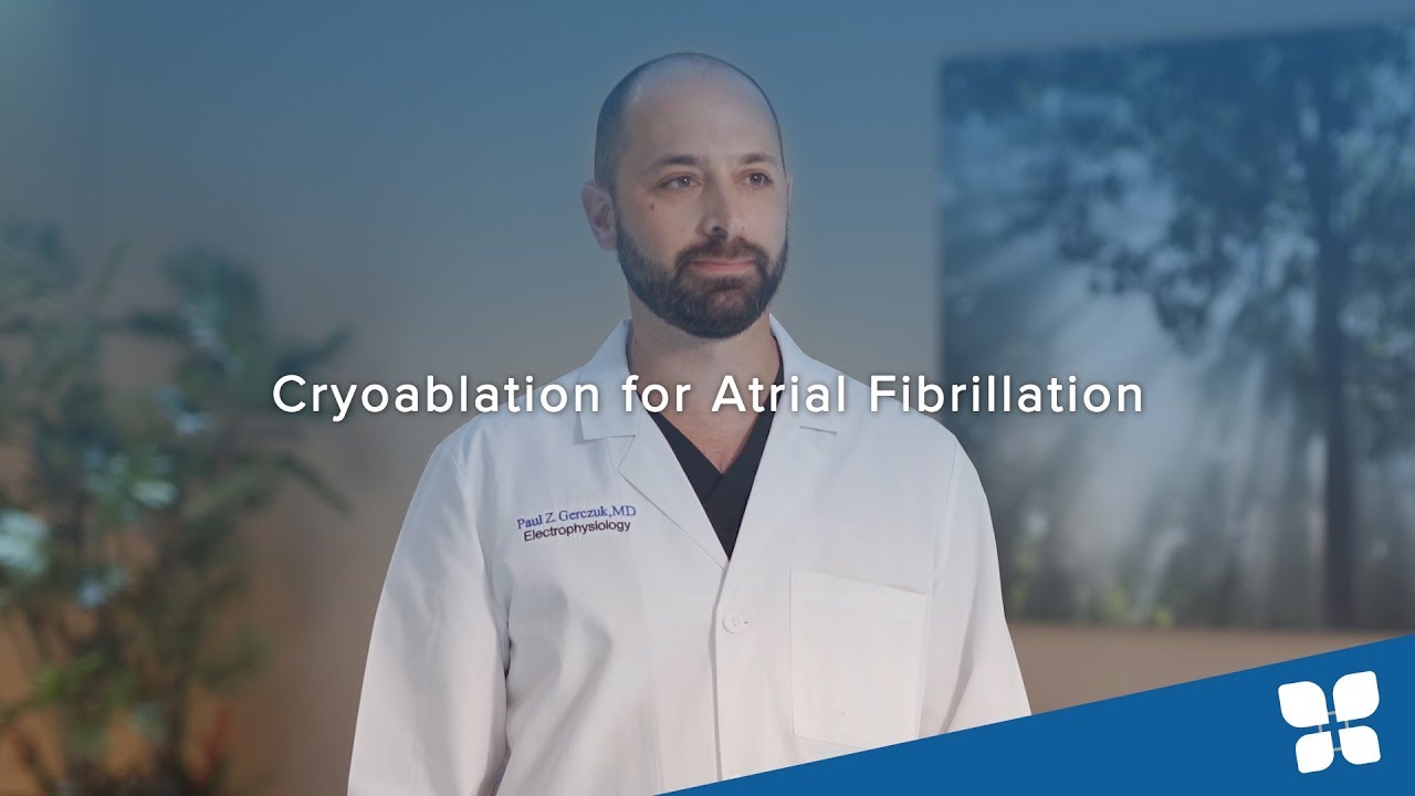 Cryoablation for atrial fibrillation