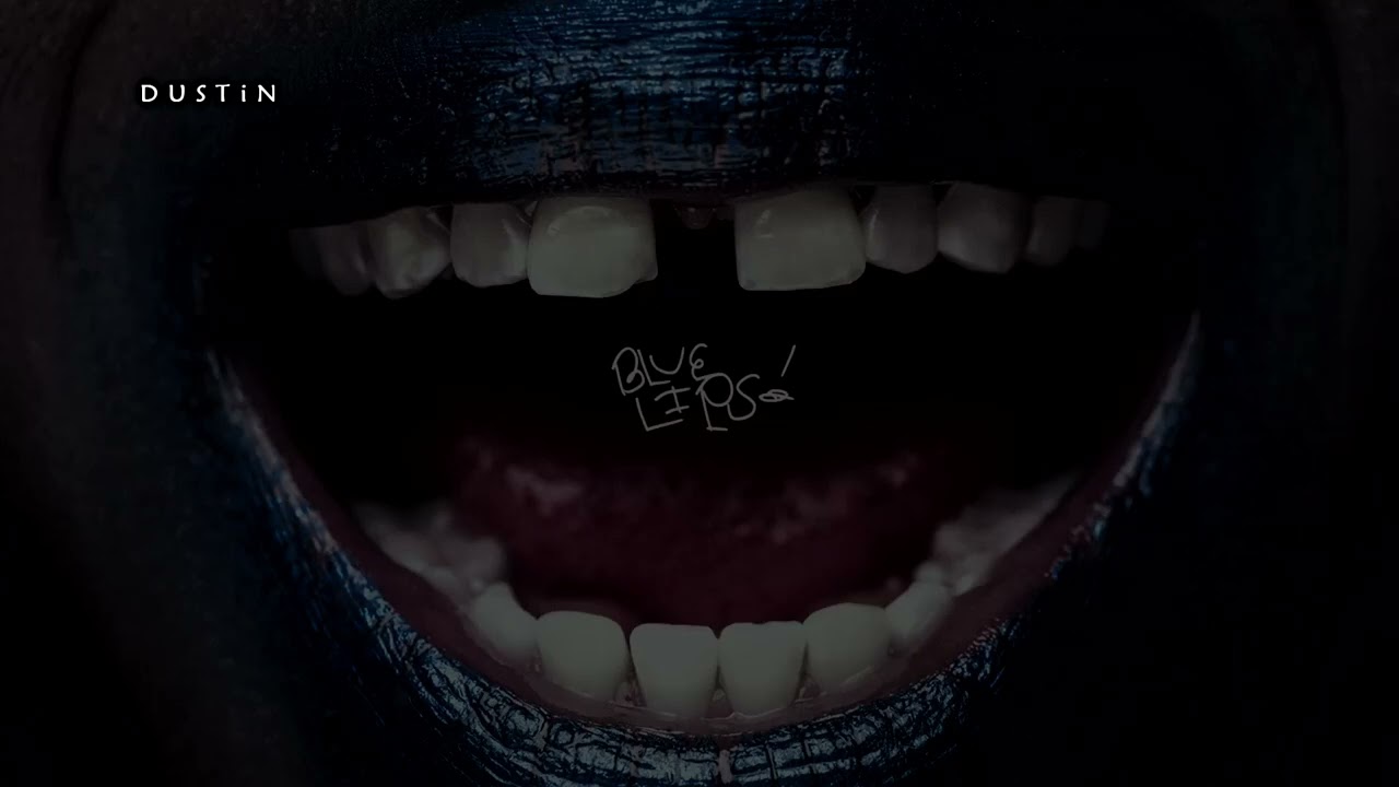 𝙎𝙘𝙃𝙤𝙤𝙡𝙗𝙤𝙮 𝙌 - 𝙋𝙊𝙋 𝙁𝙩 𝙍𝙞𝙘𝙤 𝙉𝙖𝙨𝙩𝙮 [𝙏𝙧𝙖𝙙𝙪𝙘𝙞𝙙𝙤]