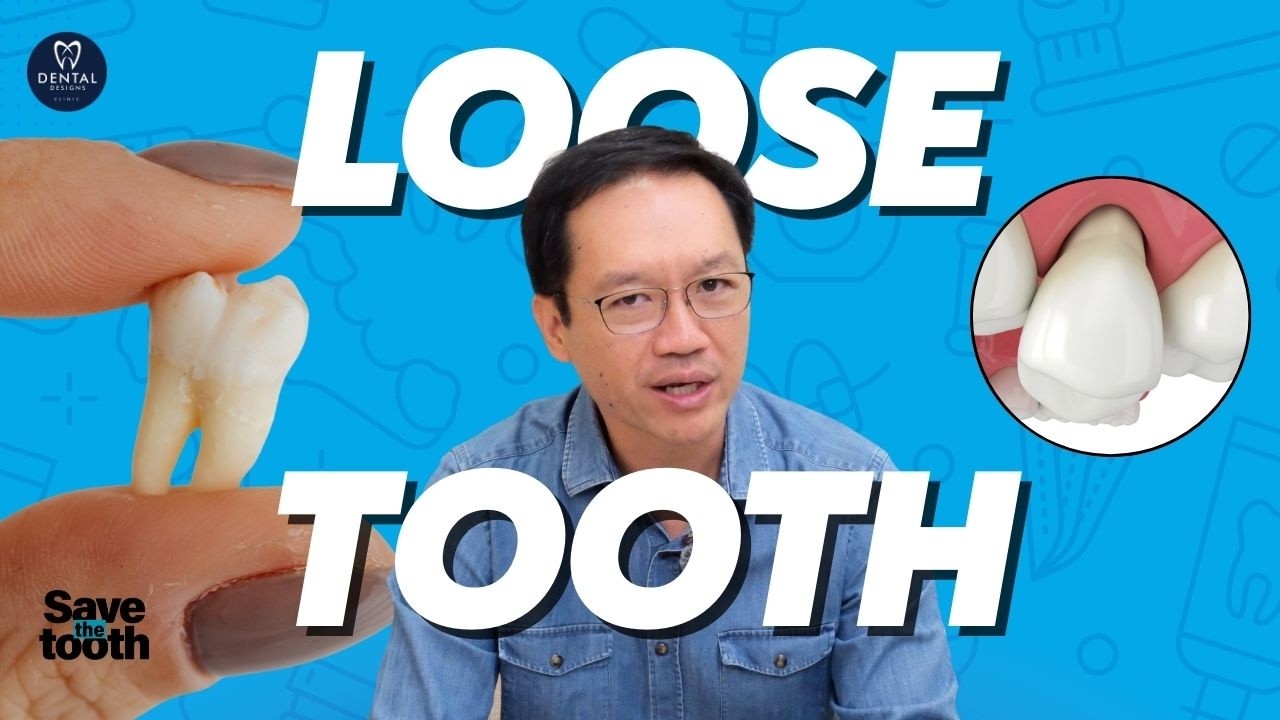 Got A Loose Tooth? | SAVE THE TOOTH SERIES