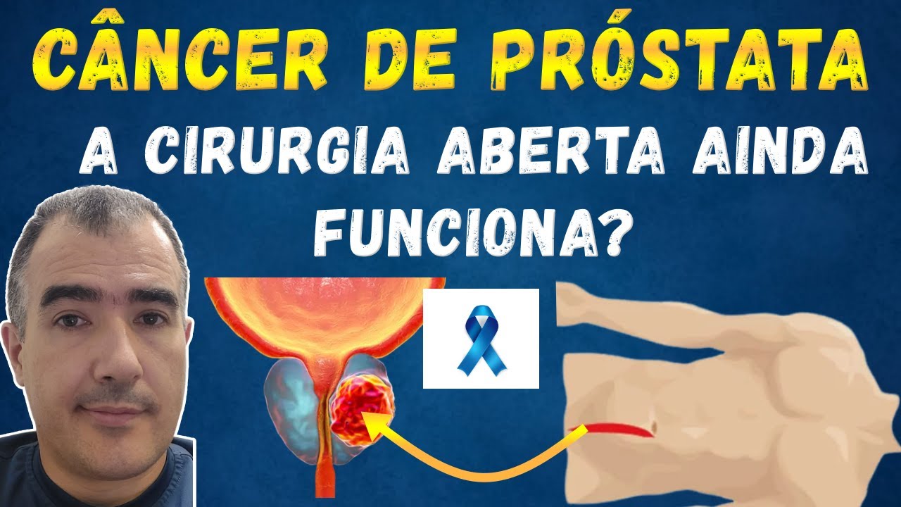 Cirurgia para câncer de próstata com corte na barriga (ABERTA) ainda é uma boa alternativa?