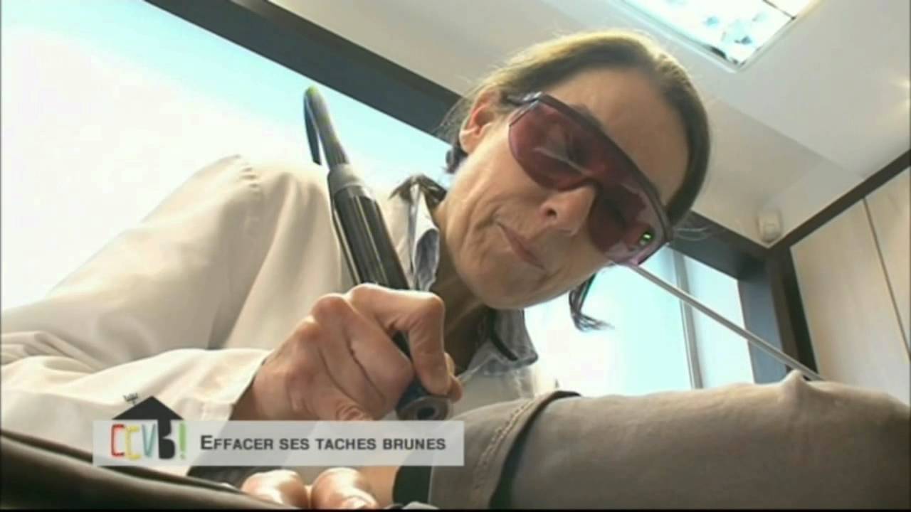 Effacer les taches brunes ou de soleil au laser : au Centre Laser CLIPP à Paris