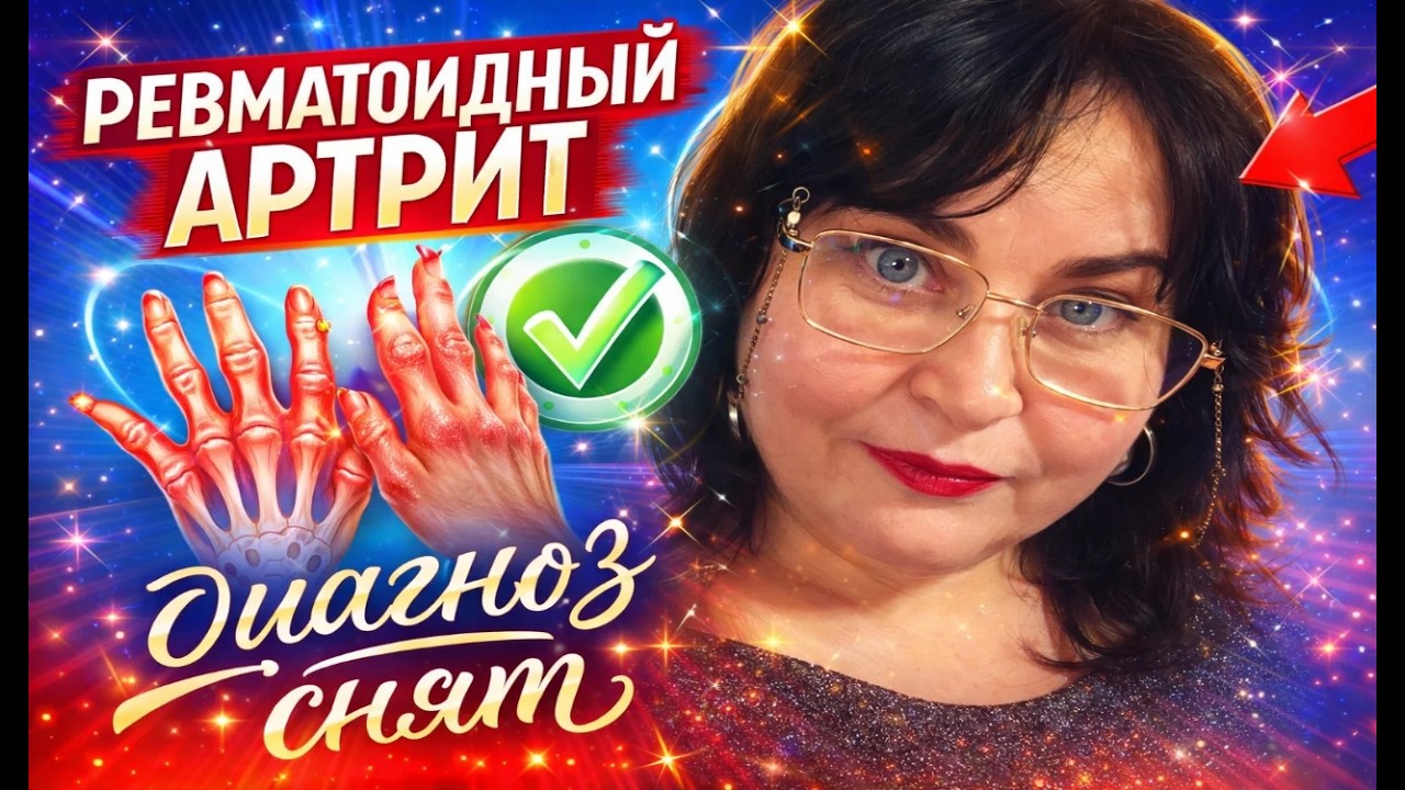 День в БЕЛГРАДЕ/РЕВМАТОЛОГ и настоящая ПЛЕСКАВИЦА