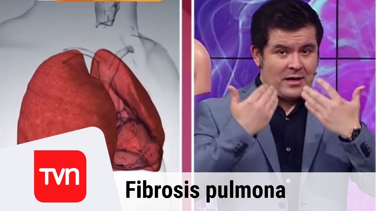 Todo lo que debes saber sobre la fibrosis pulmonar | Muy buenos días | Buenos días a todos