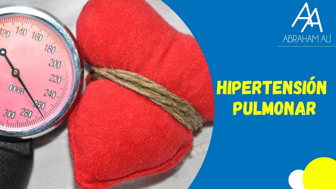Hipertensión Pulmonar Definición, Clasificación y Estudio Inicial (Primera Parte)