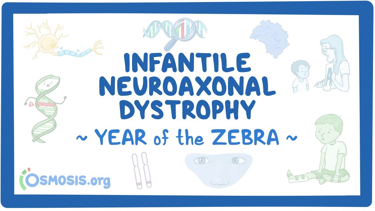 Infantile neuroaxonal dystrophy (Year of the Zebra)