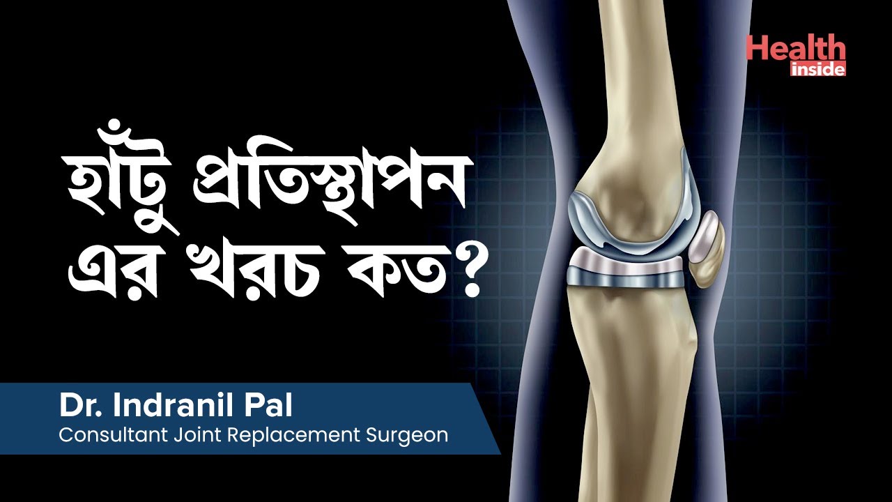 হাঁটু প্রতিস্থাপন এর খরচ কত? | Knee Replacement cost in Kolkata, West Bengal