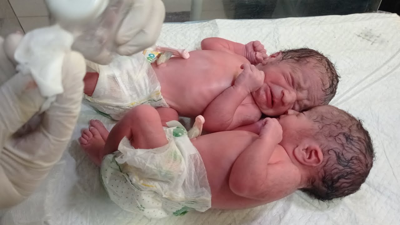 Twins Newborn Baby Care | Umbilical Cord Care, Suction & Emergency Care in NICU