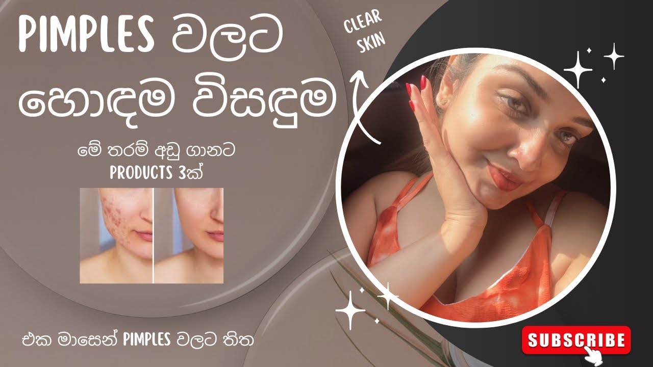 Pimples වලට හොඳම products😍| රු.500ට අඩුවෙන්✅ @TharushiChanchala 