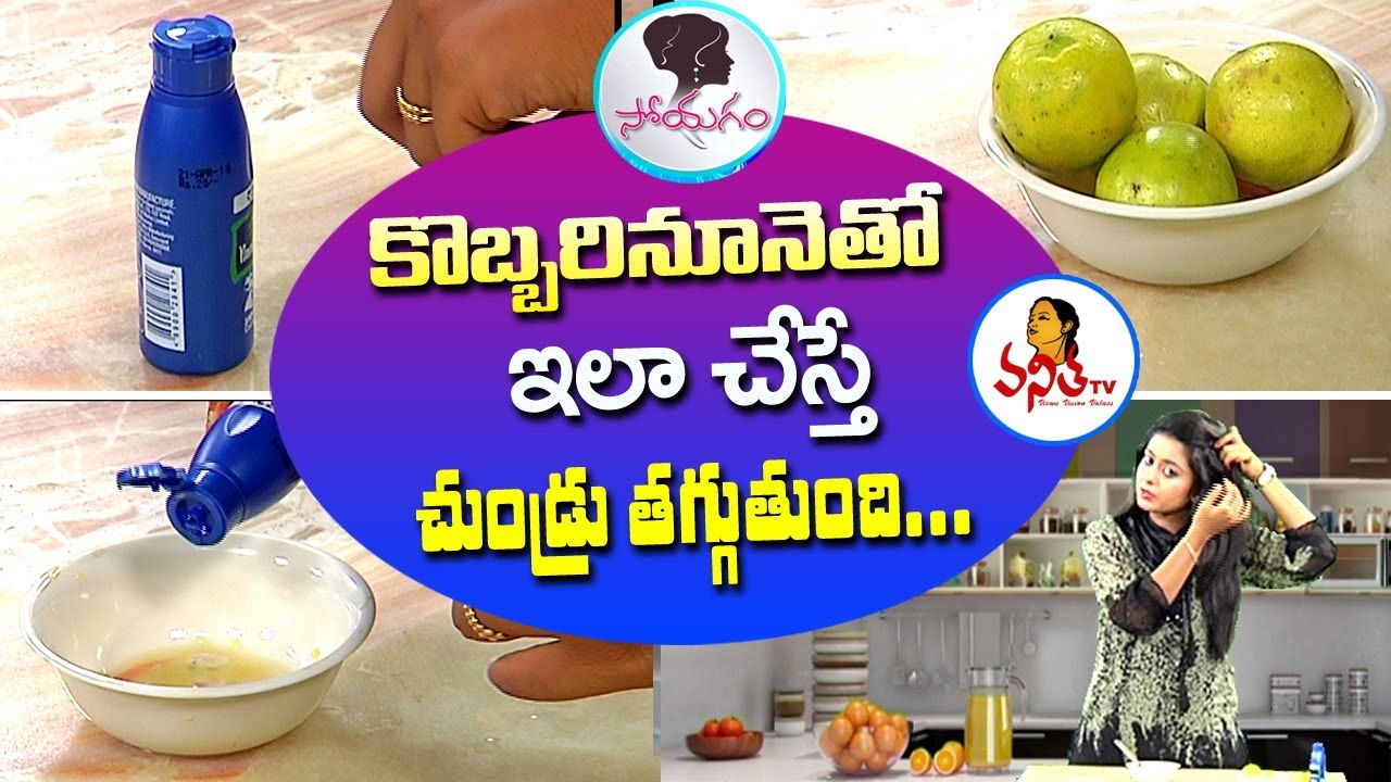 How To Get Rid Of Dandruff Permanently with Coconut Oil & Lemon | Soyagam | Vanitha TV